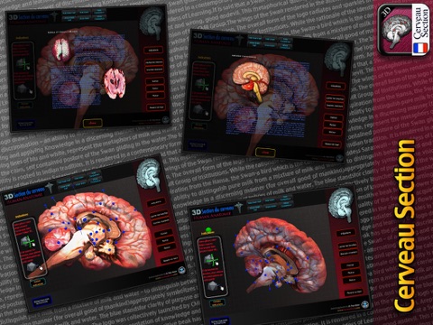 Section du Cerveau screenshot 3