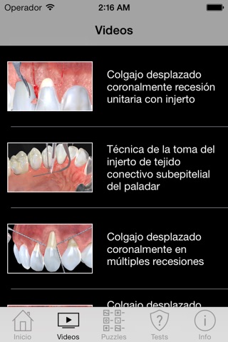 Periodontal Advanced Surgery By Mariano Sanz screenshot 2