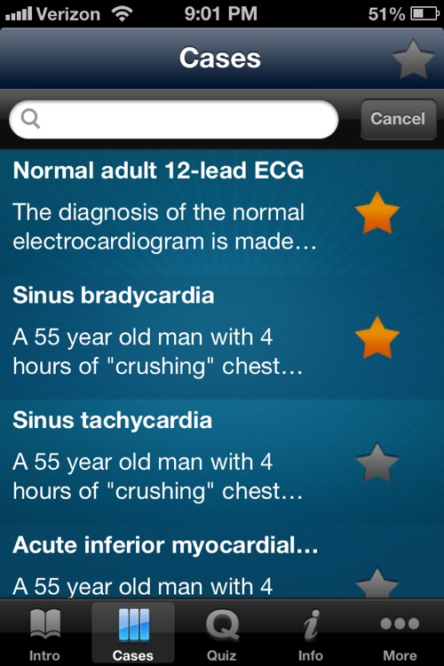 ECG - An Electrocardiogram Review for Healthcare Professionals screenshot-4