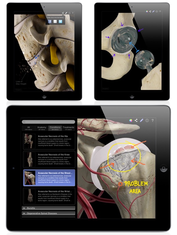 Orthopedic Patient Education screenshot-3