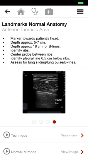 Shock Echo(圖5)-速報App