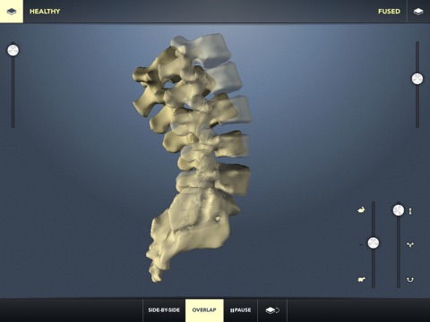 The Kinetic Spine (Free) screenshot 4