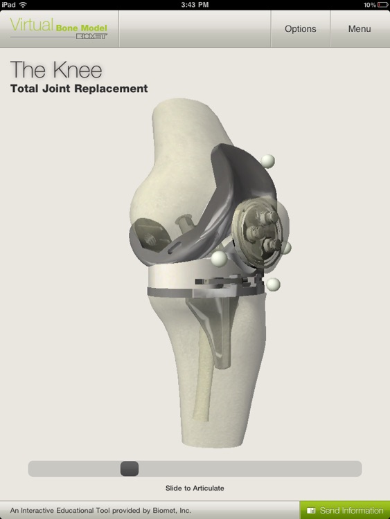 Biomet Virtual Bone Model screenshot-4