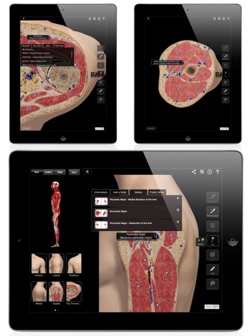 Shoulder Pro III for iPad screenshot 3
