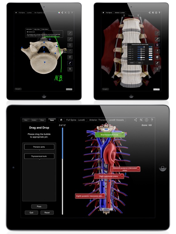 3d4medical limited