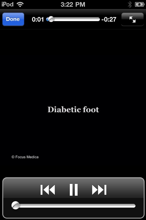 Animated Quick Reference Guide -  DiabeticFoot