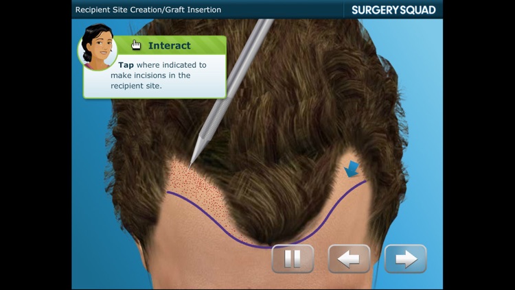 Hair Transplant - Surgery Squad screenshot-4