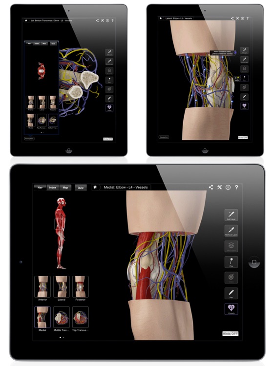 Elbow Pro III for iPad screenshot-3