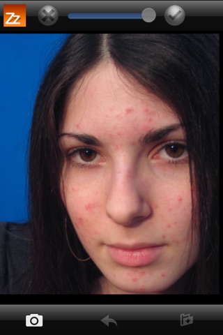 Blemish Remover HD screenshot 4