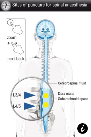 Spinal Vademecum screenshot 3