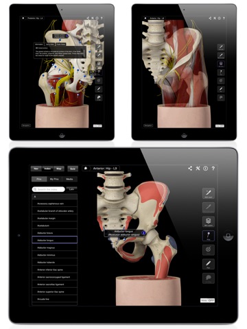 Hip Pro III for iPad screenshot 4