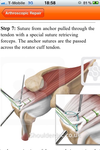 ShoulderDoc screenshot 4