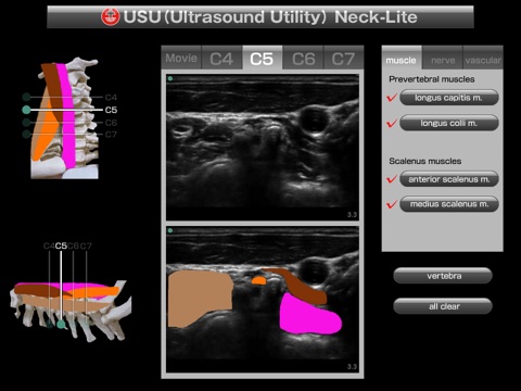 USU neck-lite screenshot 2