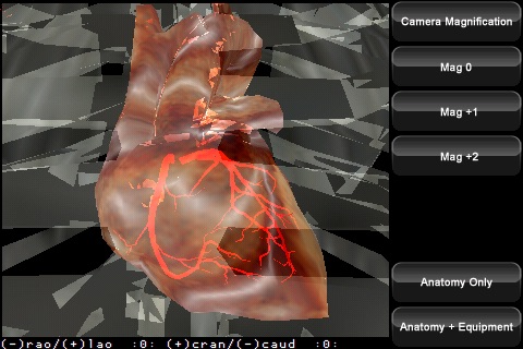 iVCLv2.0 - Cardiac screenshot 2