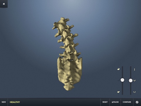 The Kinetic Spine (Free) screenshot 2
