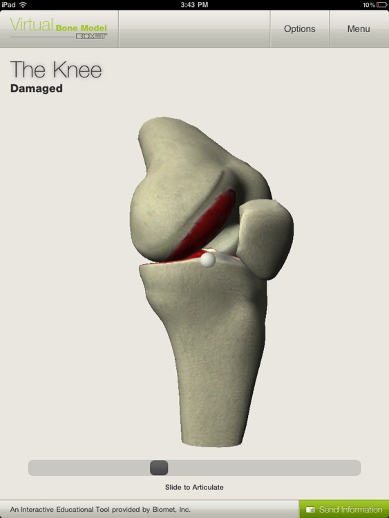 Biomet Virtual Bone Model