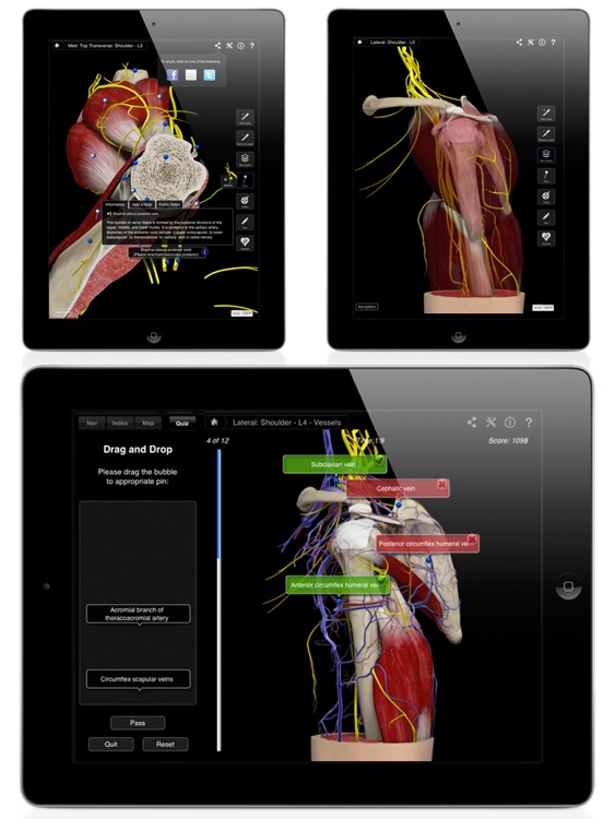 Shoulder Pro III for iPad screenshot-4