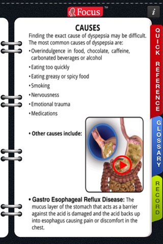 Animated Quick Reference Guide - Dyspepsia screenshot 4