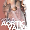 Visible Aortic