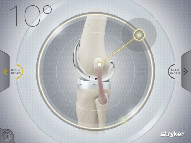 Stryker Get Around Knee