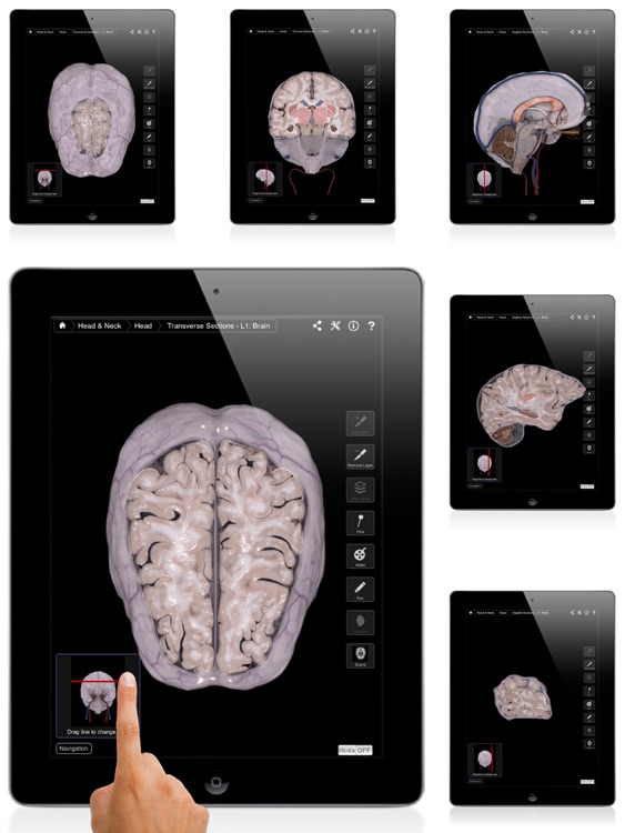 Brain & Nervous System Pro III