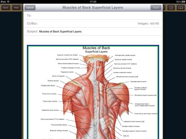 Atlas of Anatomy for iPad(圖5)-速報App