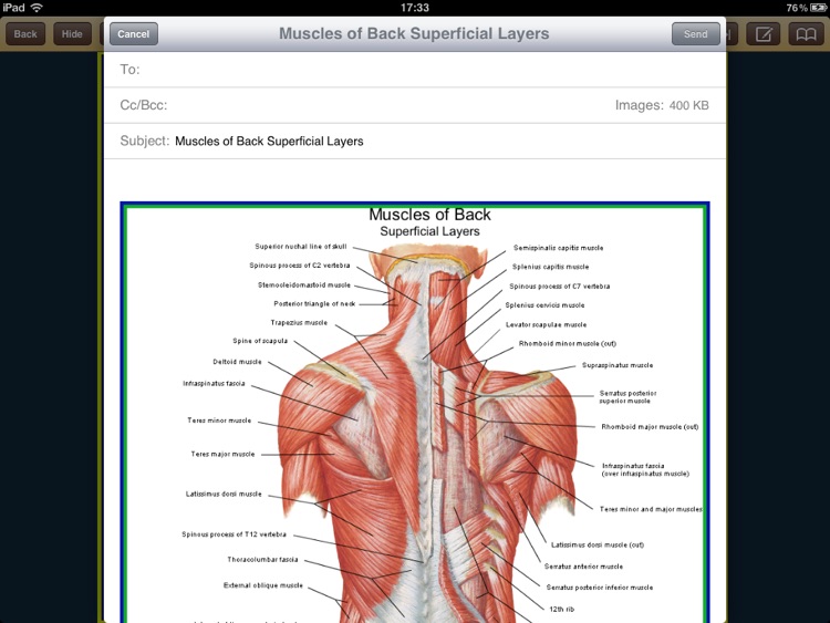 Atlas of Anatomy for iPad screenshot-4