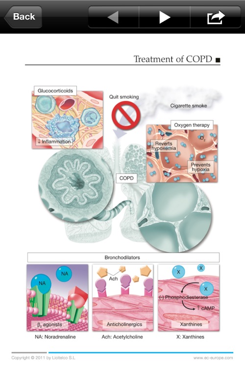 Miniatlas COPD screenshot-3