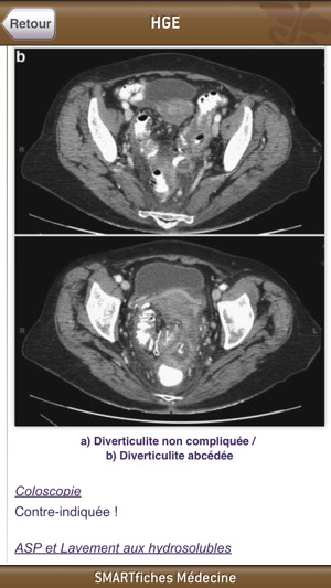 SMARTfiches Hépato-Gastro-Entérologie Free(圖5)-速報App