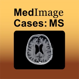 Multiple Sclerosis - MedImage Cases