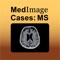 MedImage Cases(TM): Multiple Sclerosis, a new eTextbook, is a series of 26 biweekly MRI case presentations, providing audio commentary from renowned MS experts of the MRI—both conventional and non-conventional forms—to be used as a tool to measure disease activity, disease progression, and response to therapy, and guide practical therapeutic approaches