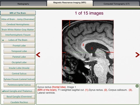 MRI-Xray Human Body screenshot 3
