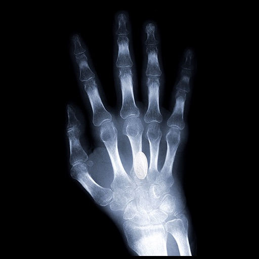 X-ray Scanner iOS App