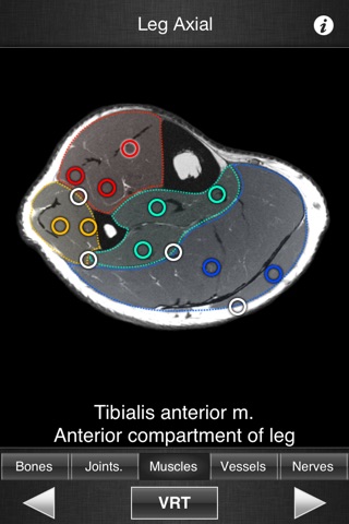 Monster Anatomy HD - Lower Limb screenshot 3