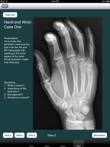 FracturED: A Fracture in the ED; Module 1: Hand and Wrist screenshot 4
