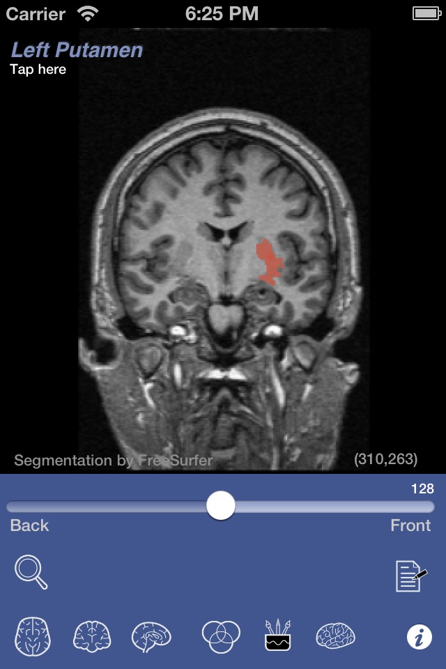 iSurf BrainView screenshot 2