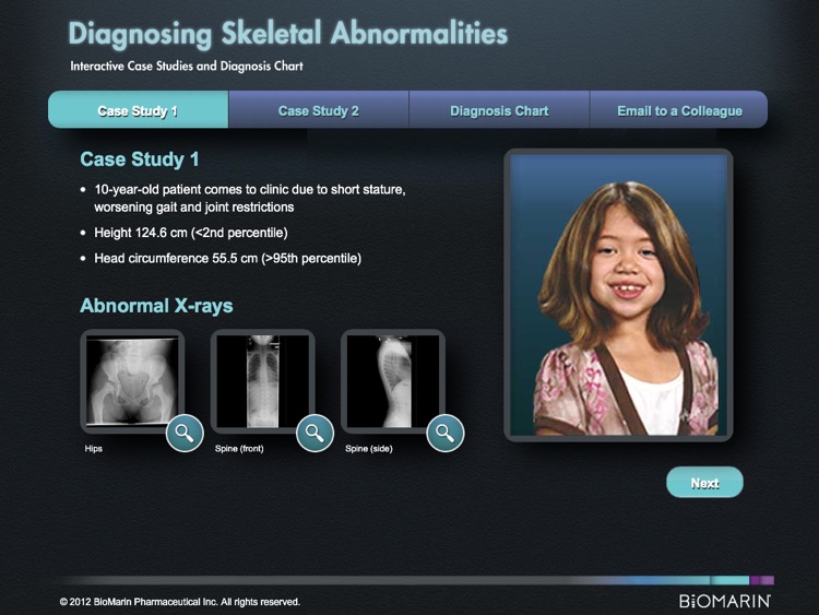 MPS Differential Diagnosis