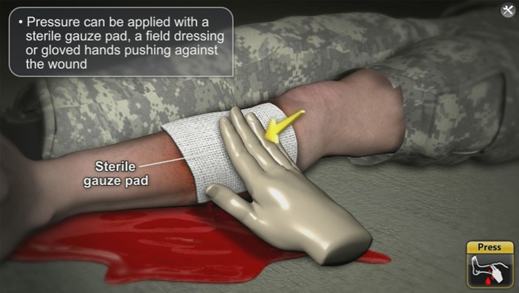 Medrills: Army Control Bleeding