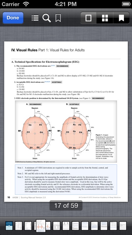 The AASM Manual for the Scoring of Sleep and Associated Events