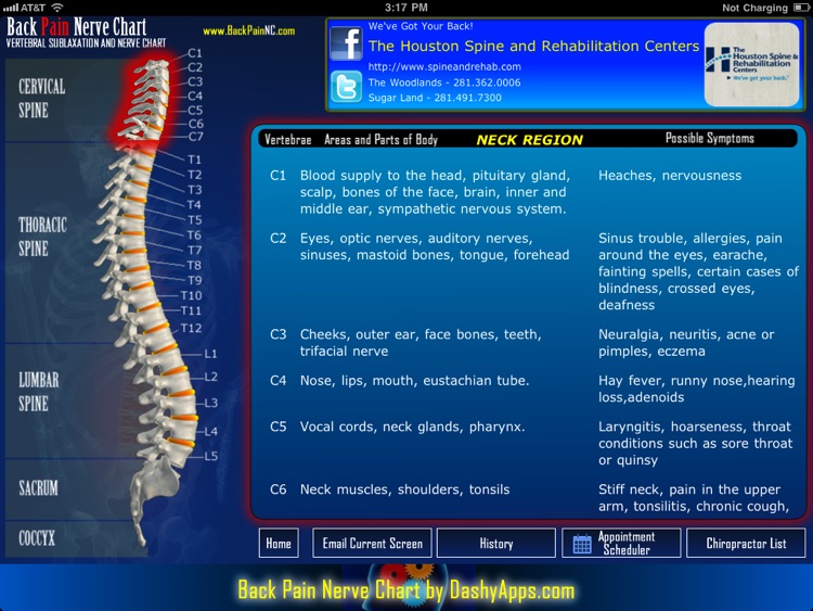 Back Pain Nerve Chart
