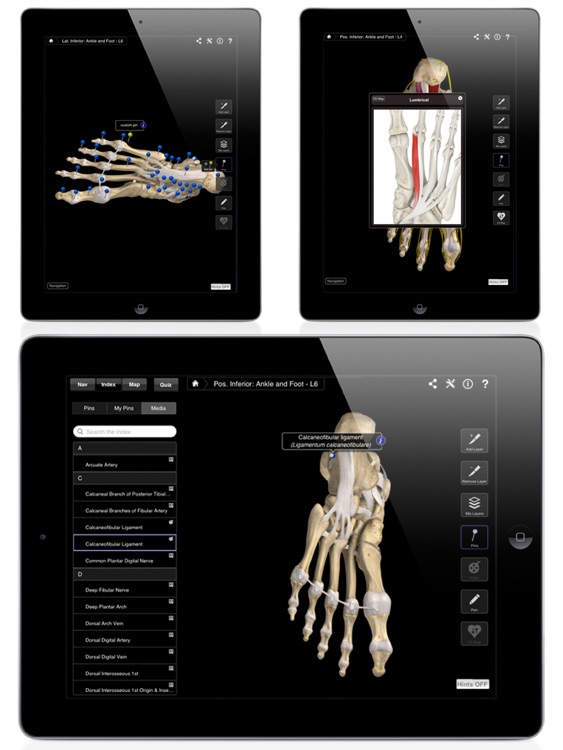 Ankle & Foot Pro III for iPad screenshot-3