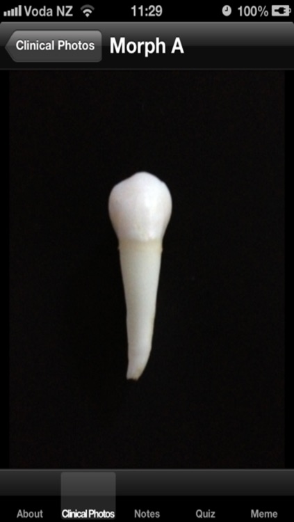Tooth Morphology Exam preparation