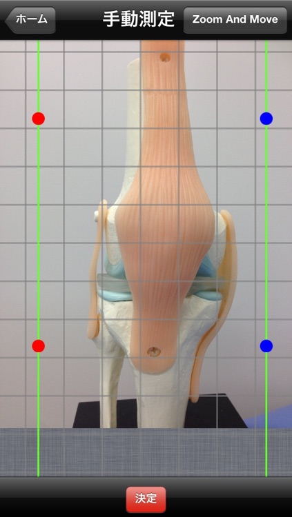 Measurement of ROM Angle - use 4 markers