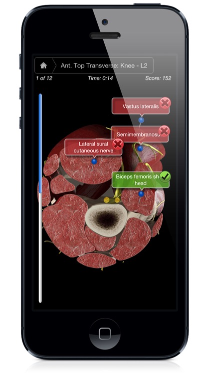 Knee Pro III with Animations - iPhone Edition