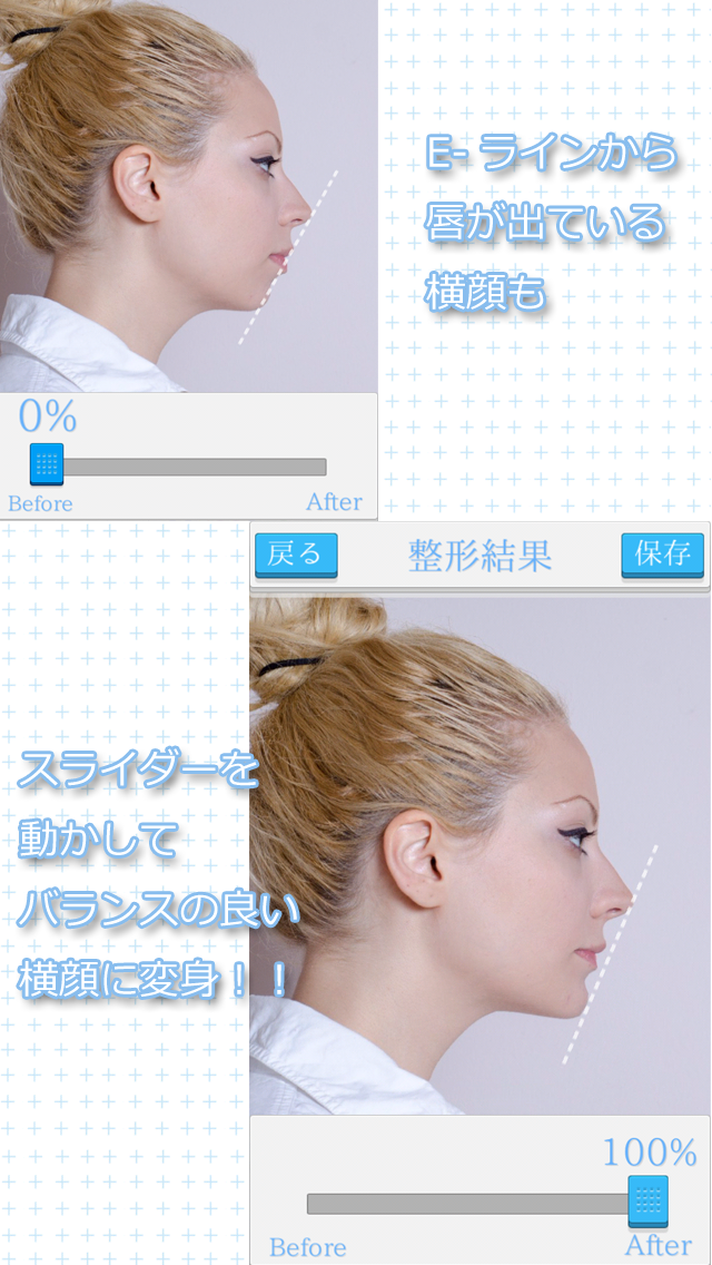 横顔e ライン整形 あなたの写真を美容的にバランスの良い美横顔に変換 Iphoneアプリ Applion