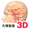 脳血管3Dイラスト