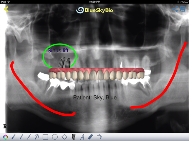 BIO View(圖4)-速報App