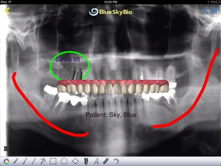 BIO View screenshot-3