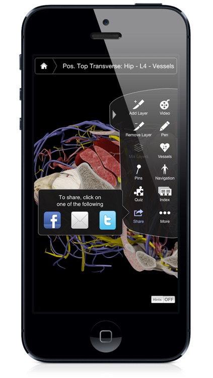 Hip Pro III with Animations - iPhone Edition screenshot-4