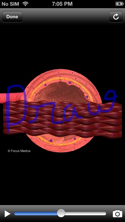 Atlas of Hypertension screenshot-3